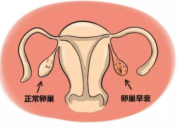 卵巢功能下降有哪些症状