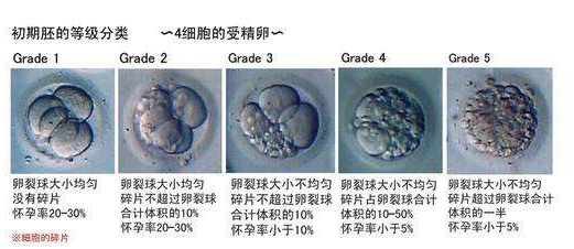 试管婴儿胚胎等级怎么看