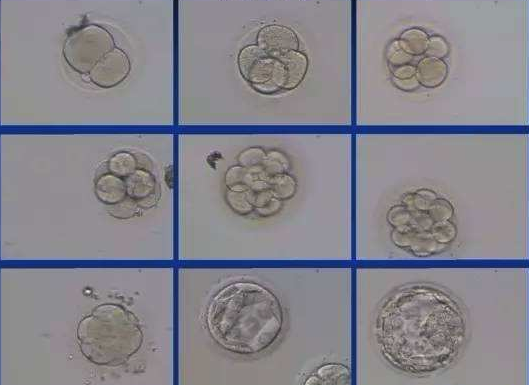 怎么提高囊胚移植的成功率