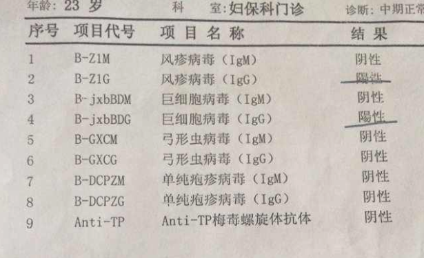 风疹病毒化验单