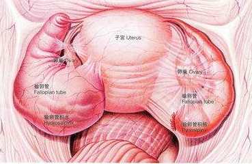 子宫内膜异位症的症状有哪些