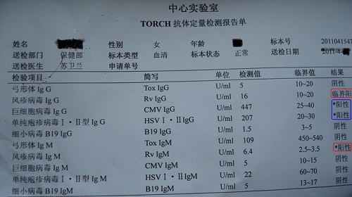 torch优生五项检查什么