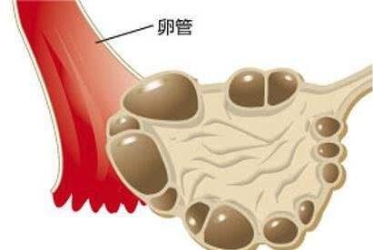 原发性不孕的原因是什么