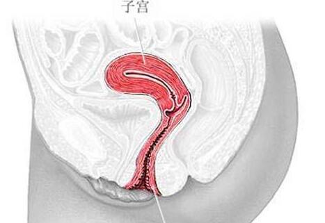 子宫内膜息肉怎么治疗