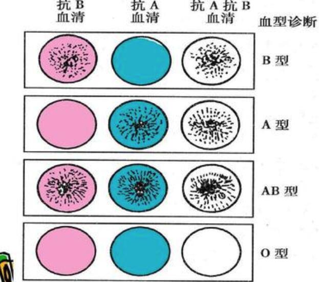 血型检查如何做