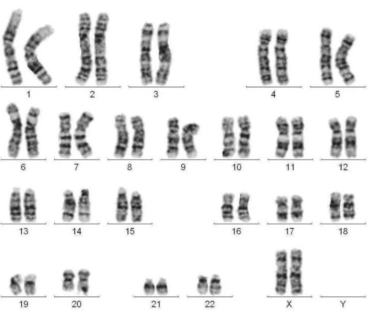 染色体检查有哪些项目