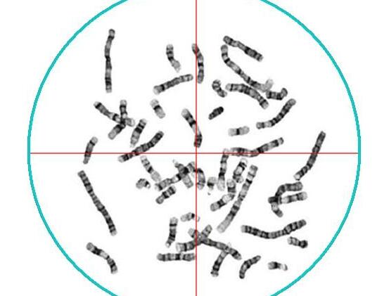 染色体检查需要多少钱