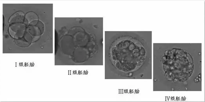 胚胎质量等级划分