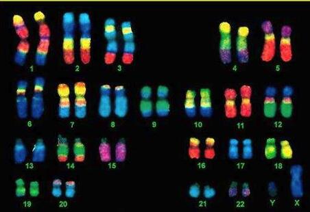 为什么要做染色体检查