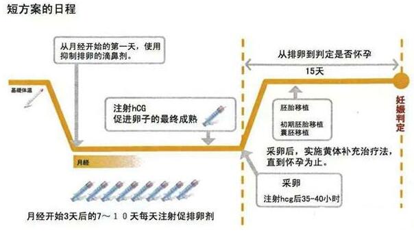 试管促排短方案要打多少天针