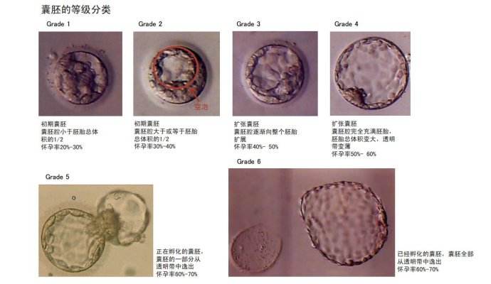 <a href='https://www.youxiivf.com/ptdj' title='胚胎等级' target='_blank'>胚胎等级</a>分级决定成功率吗？.jpg