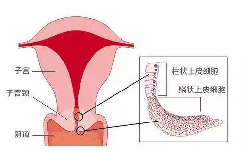 宫颈糜烂检查多少钱