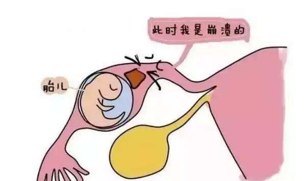 做试管婴儿为什么也会宫外孕