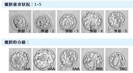 囊胚等级的划分