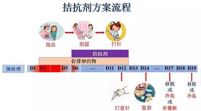 拮抗剂方案卵泡质量好吗