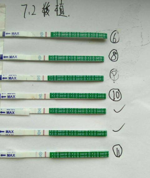 试管移植第11天成功案例分析