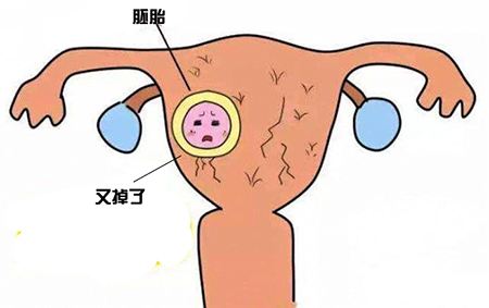 腹腔镜检查报告有效期多久