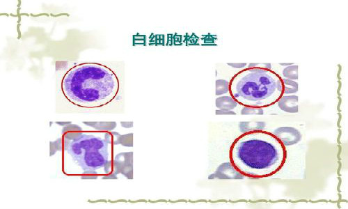 白细胞怎么检查