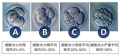 试管胚胎等级成功率哪个高