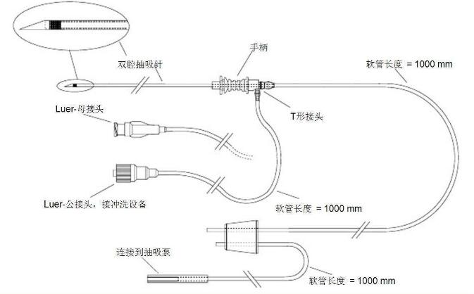 腹部穿刺取卵术操作方法