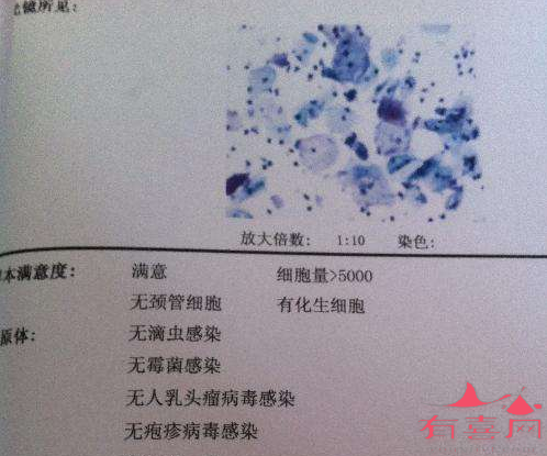 tct有化生细胞啥意思