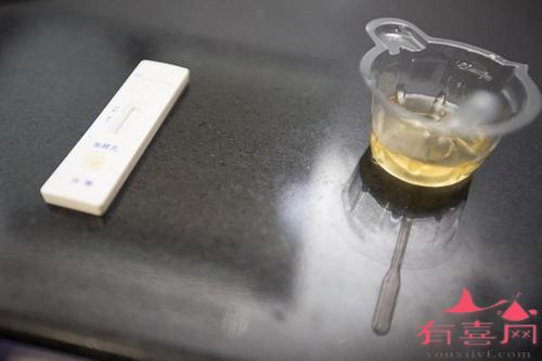 尿酸碱度检查的临床意义你都知道吗