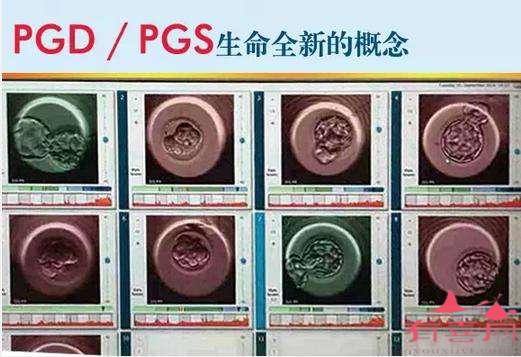 我国PGD/PGS技术还不够成熟