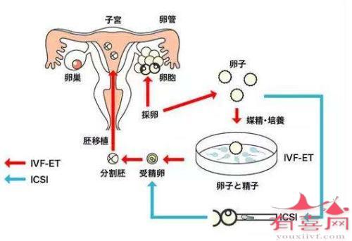 体外受精过程