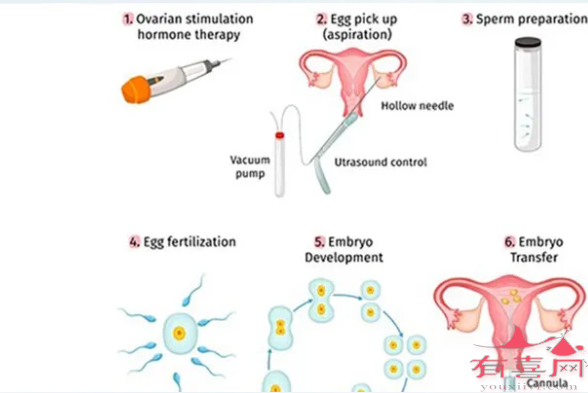辽宁试管婴儿流程