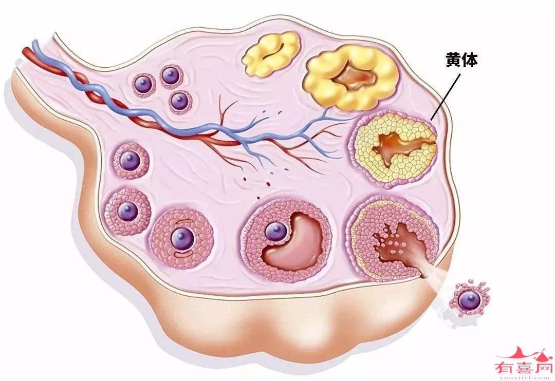 黄体破裂后该怎么治疗