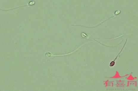 精子活动率10%正常吗