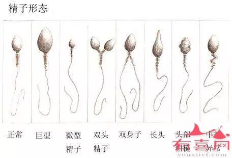 精子畸形率8%正常吗