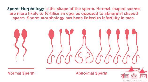 精子畸形率11%正常吗