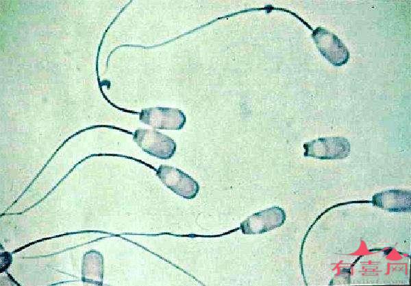 精子畸形率93%正常吗