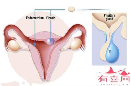 子宫内膜厚度6mm可以移植胚胎吗