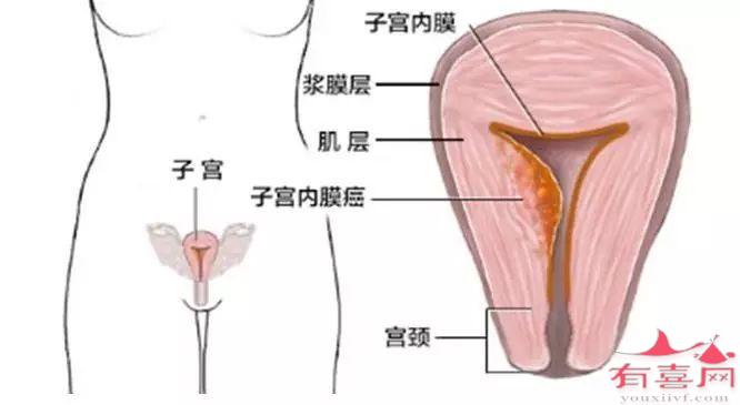 子宫内膜厚度7mm可以移植胚胎吗