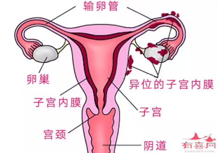 子宫内膜厚度15mm可以移植胚胎吗