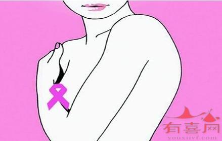 孕前检查会检查乳腺吗