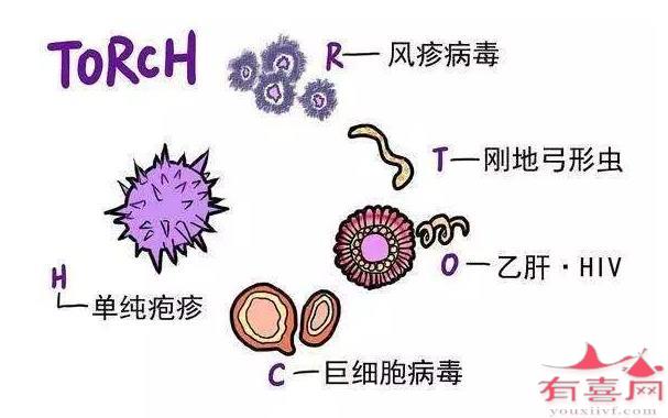 孕前torch检查单