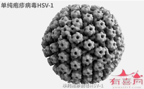 单纯疱疹病毒1型(HSV-1)IgG抗体是什么