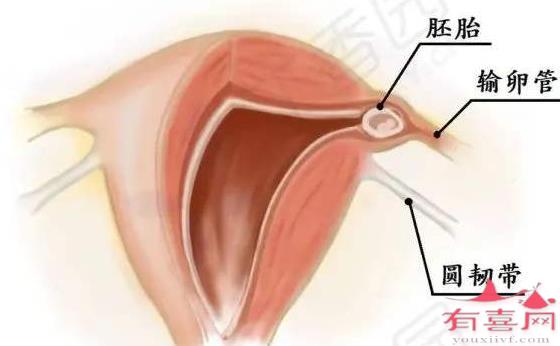 宫角妊娠几周最危险