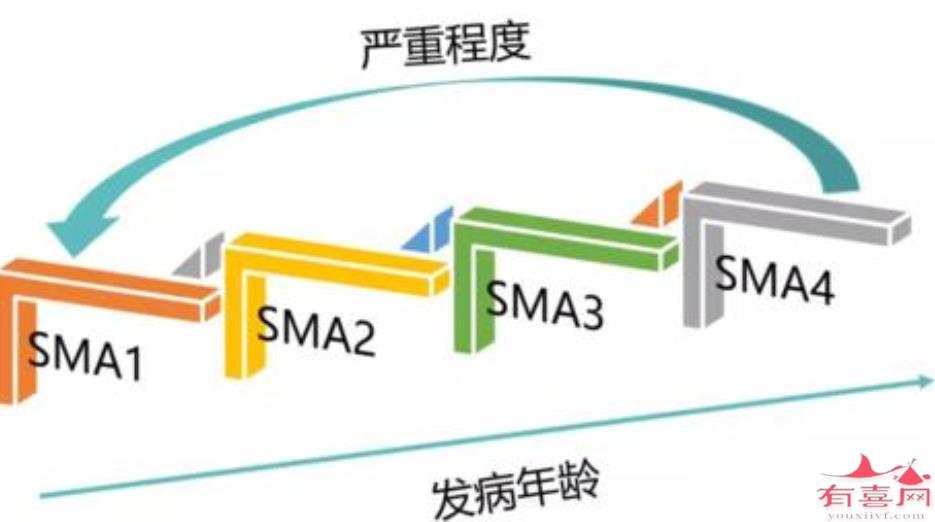 脊肌萎缩症是什么病