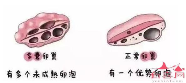 卵泡长不大是什么原因