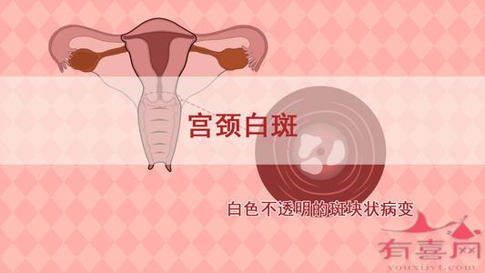 宫颈检查有白斑严重吗