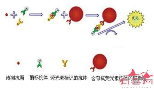 酶免法与金标法对比：检测性病原理及准确度区别分析