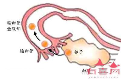 输卵管堵塞检查什么项目呢