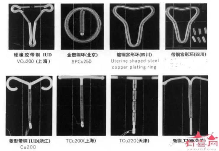 节育环的种类图片