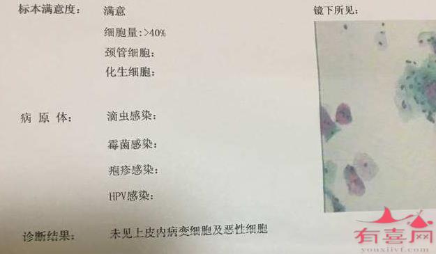 tct检查结果有几种