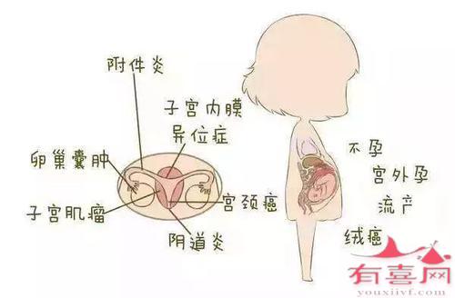 慢性附件炎的症状