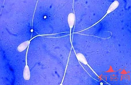轻度弱精症能自然怀孕吗